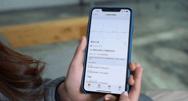 国行版本的 Apple  Watch  如何激活使用 ECG  心电图功能？