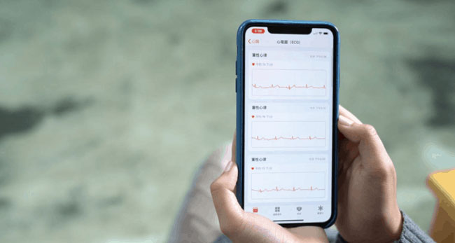 国行版本的 Apple  Watch  如何激活使用 ECG  心电图功能？