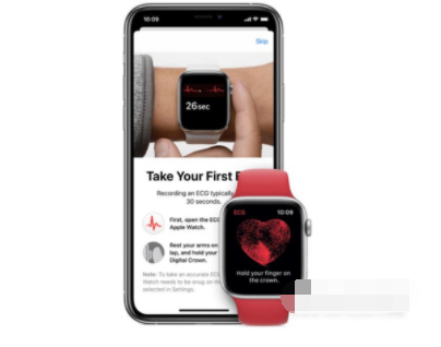 AppleWatchSeries7支持心电图吗