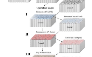 科学家合成牙齿涂层：硬度超天然珐琅 可修复牙齿